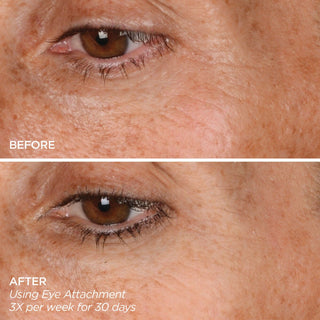 The Eye Brightening Duo Skincare BeautyBio 