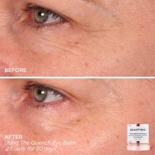Eye Want It All Set Set BeautyBio
