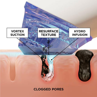 Pro Hydration Facial GLOfacial BeautyBio 