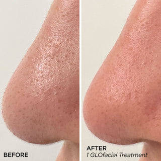 GLOfacial Results